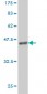 MS4A1 Antibody (monoclonal) (M01)
